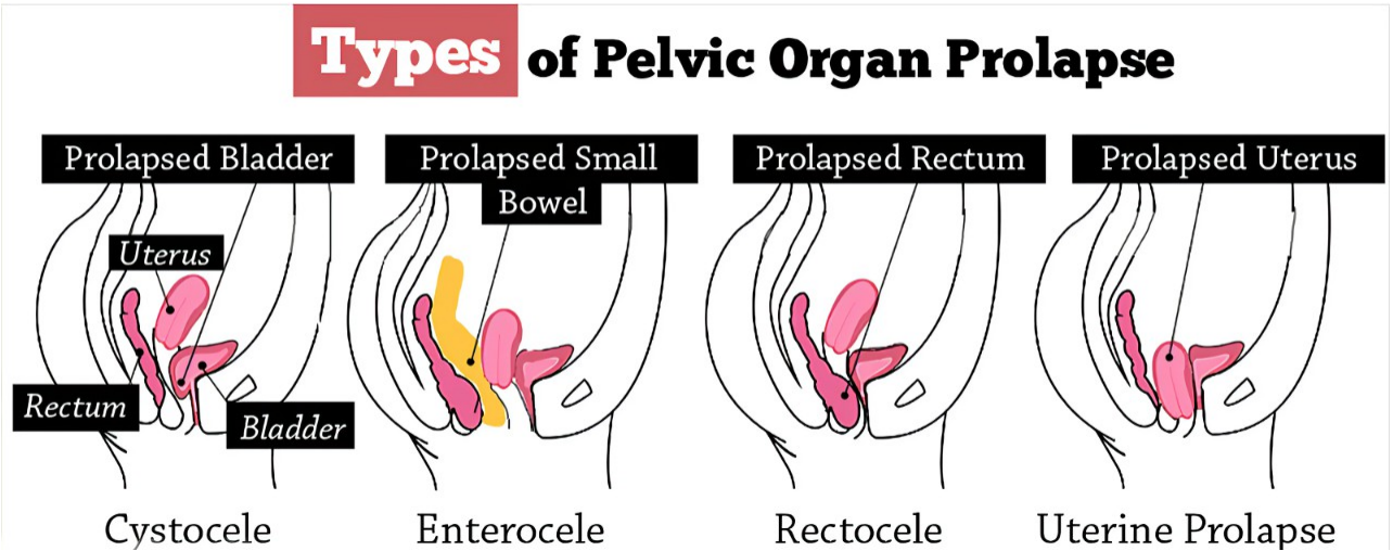 16837704163343.png 16837704163343.png