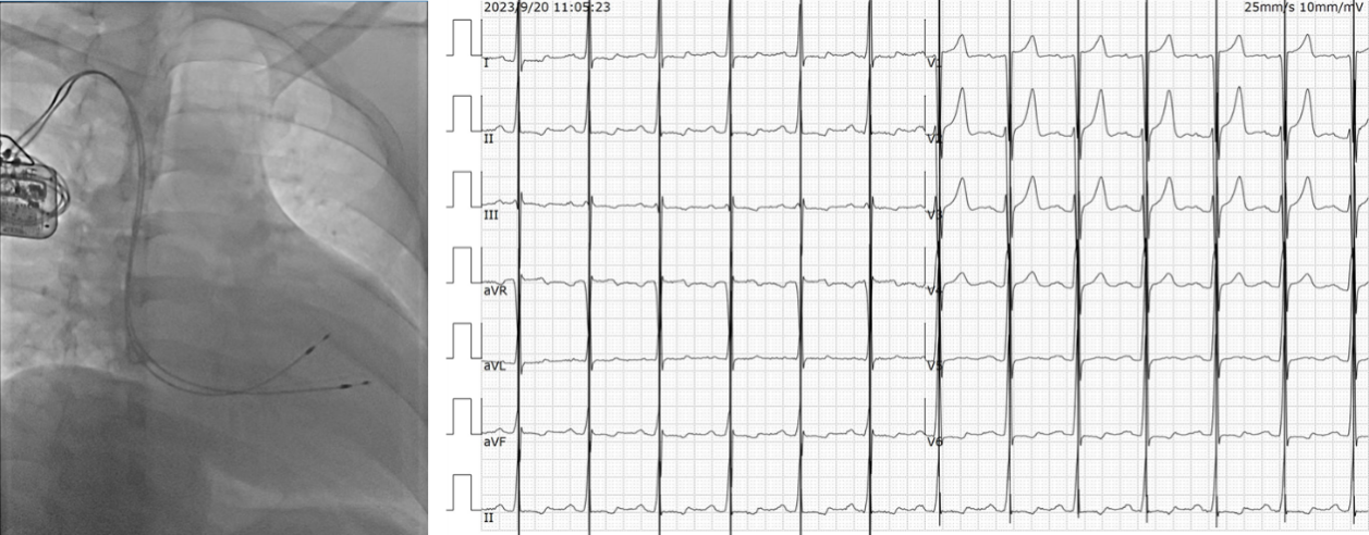 16988885644935.png 16988885644935.png