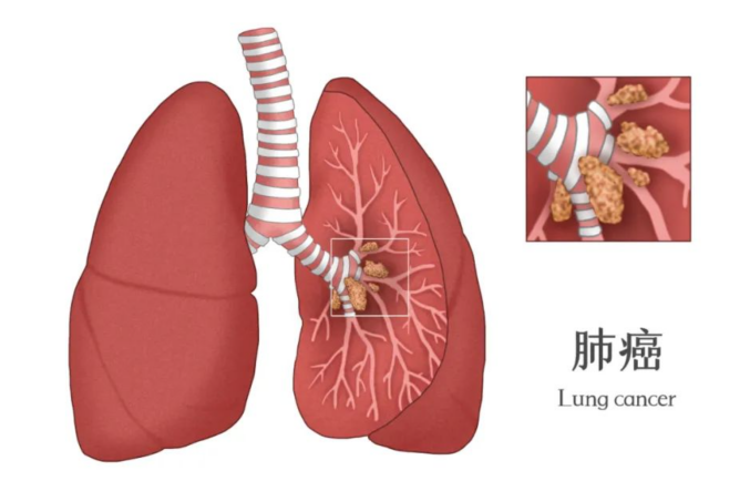 17000153159928.png 17000153159928.png