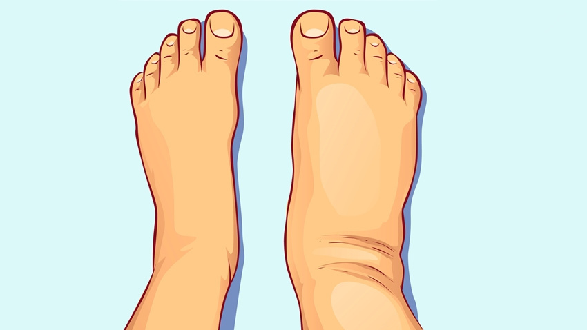 17030424281646.png 17030424281646.png