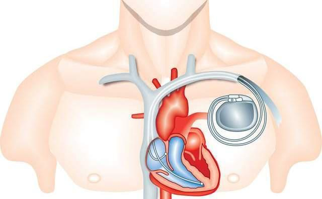 17044270058377.png 17044270058377.png