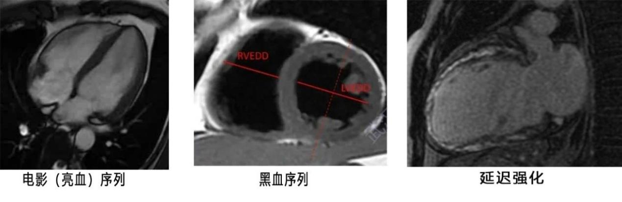 17132285178849.png 17132285178849.png