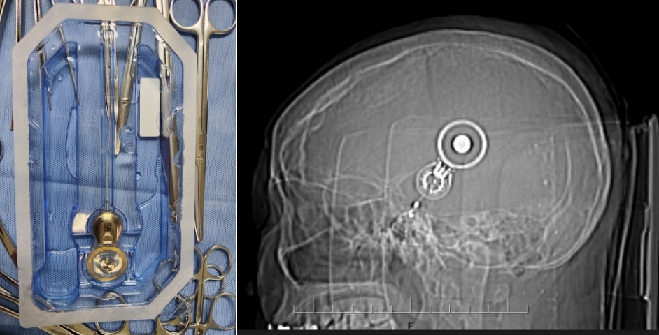 17448505434190.png 17448505434190.png