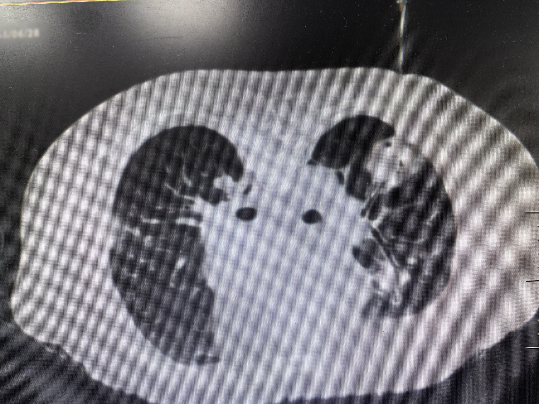 17591091898915.png 17591091898915.png