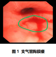 17610161673093.png 17610161673093.png